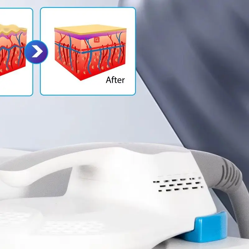 

6500W Myoslim Neo RF EMS Body Sculpt Machine Muscle Stimulation Massager Sculpting Butt Fat Slimming Weight Loss Device Salon