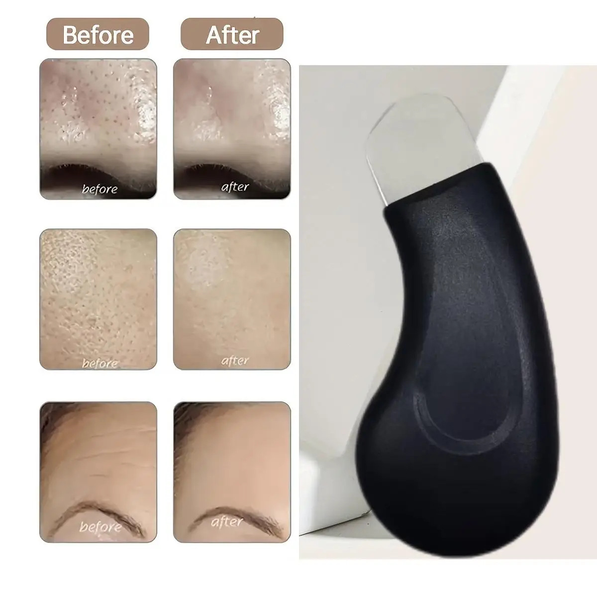 Extrator manual de acne, capaz de limpar a pele do nariz e do rosto, ferramenta de cuidados de beleza