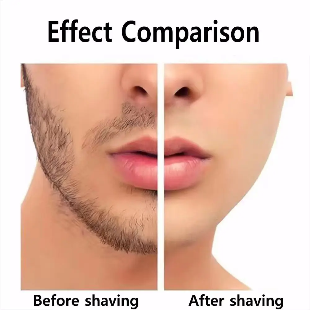 For Xiaomi Mijia S101 S301 Electric Shavers Replace Blade Beard Trimmer Razor Replacement Head - Blue/Silver/black ﻿ view 5