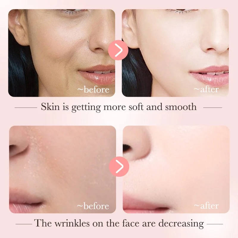 مصل النياسيناميد BIOAQUA لتقليل البقع الداكنة وتبييض وترطيبها وتفتيح لون البشرة 30 مل