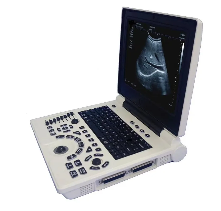 Direct factory sales XF P20 Ultrasound Scanner Veterinary Machine Laptop 12 Inch Portable Black White with Micro convex probe