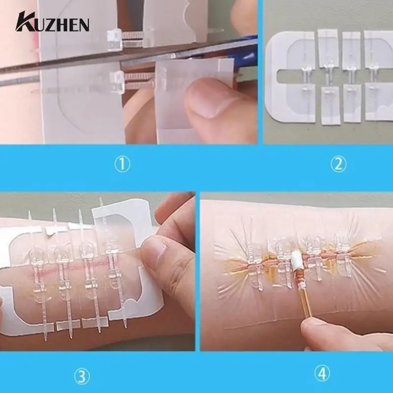 1/2/10Pcs Zipper Tie Wound Closure Patch Hemostatic Patch Wound Fast Suture Zipper Band-Aid Outdoor Portable Skin Care