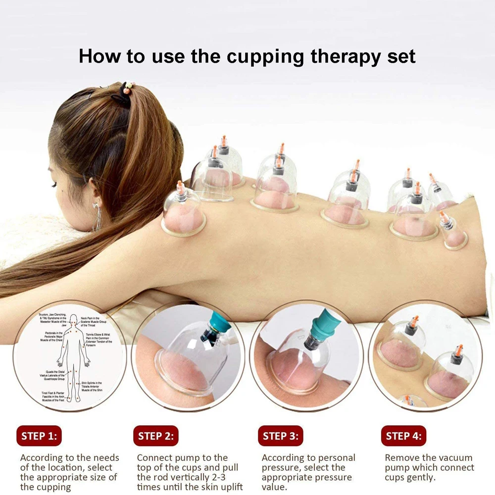 Conjuntos de terapia de ventosas, Hijama, ventosas de vacío, 24 tazas, masaje de ventosas para celulitis, alivio del dolor de espalda, ventosas chinas