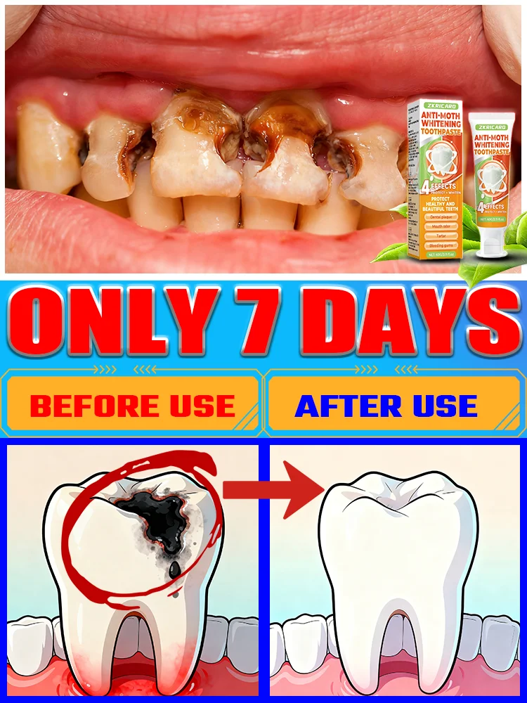 

Highly effective oral care: Pʀᴇᴠᴇɴᴛs ᴄᴀᴠɪᴛɪᴇs ᴡʜɪʟᴇ ʀᴇᴘᴀɪʀɪɴɢ ᴅᴇᴄᴀʏ ᴍᴀʀᴋs.