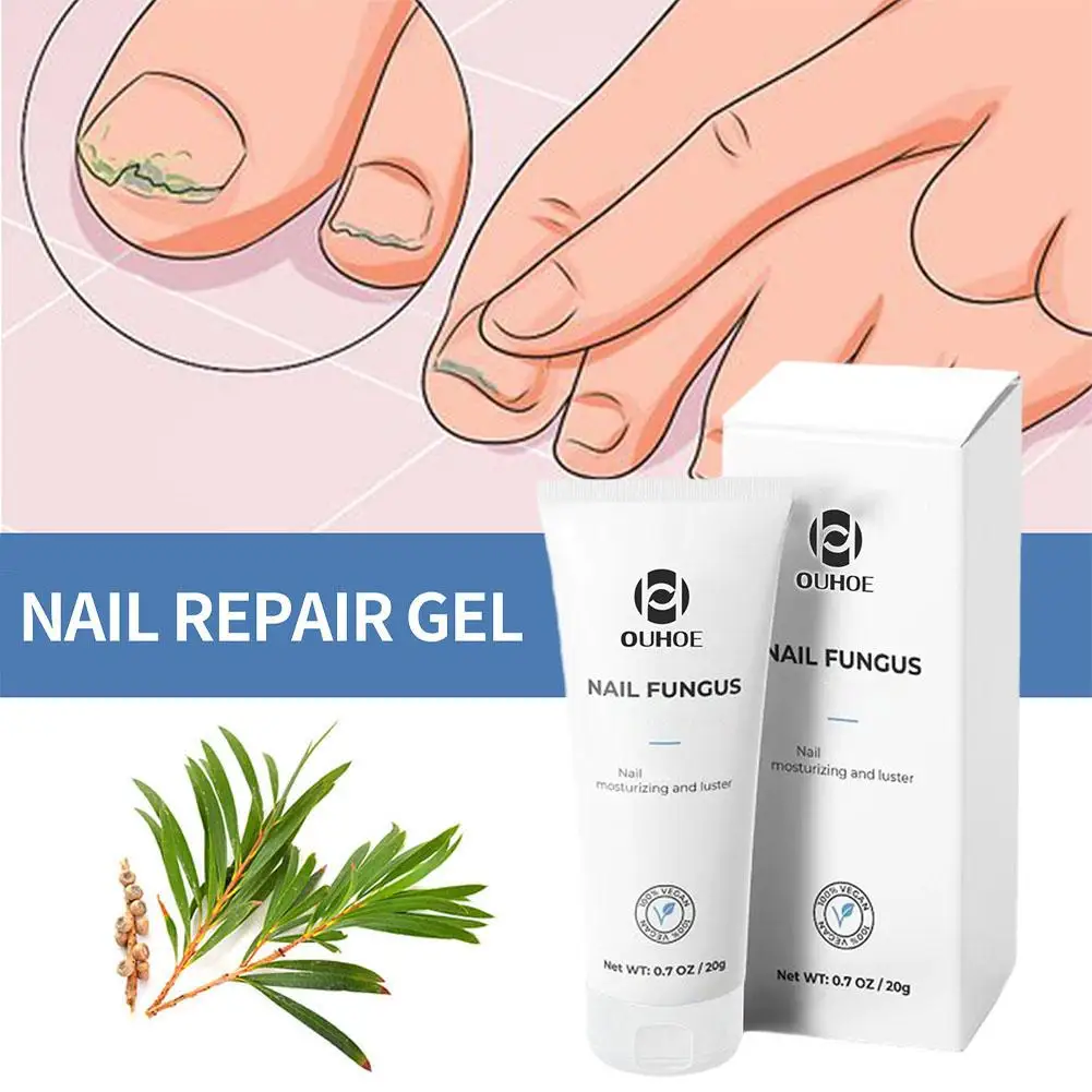 Ouhoe Nail Fungal Care Gel Remove Onychomycosis Effective Foot Care Nourishing Treatment Nails Soften And Hand Nail Against L5u2