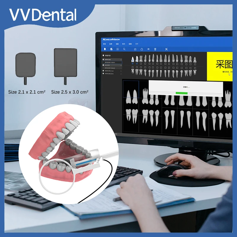 

VV стоматологический датчик RVG рентгеновский радиовиограф Интраоральная система визуализации HD изображение цифровой датчик стоматологические инструменты