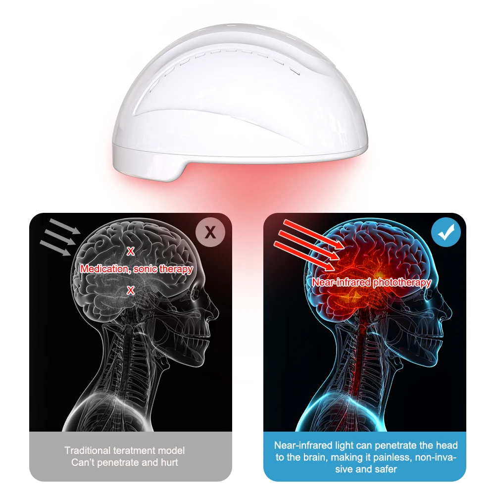 Suyzeko Photobiomodulation Brain Helmet 810nm Infrared Light Therapy Neurofeedback for Autism Disease Mental Illness Treatment