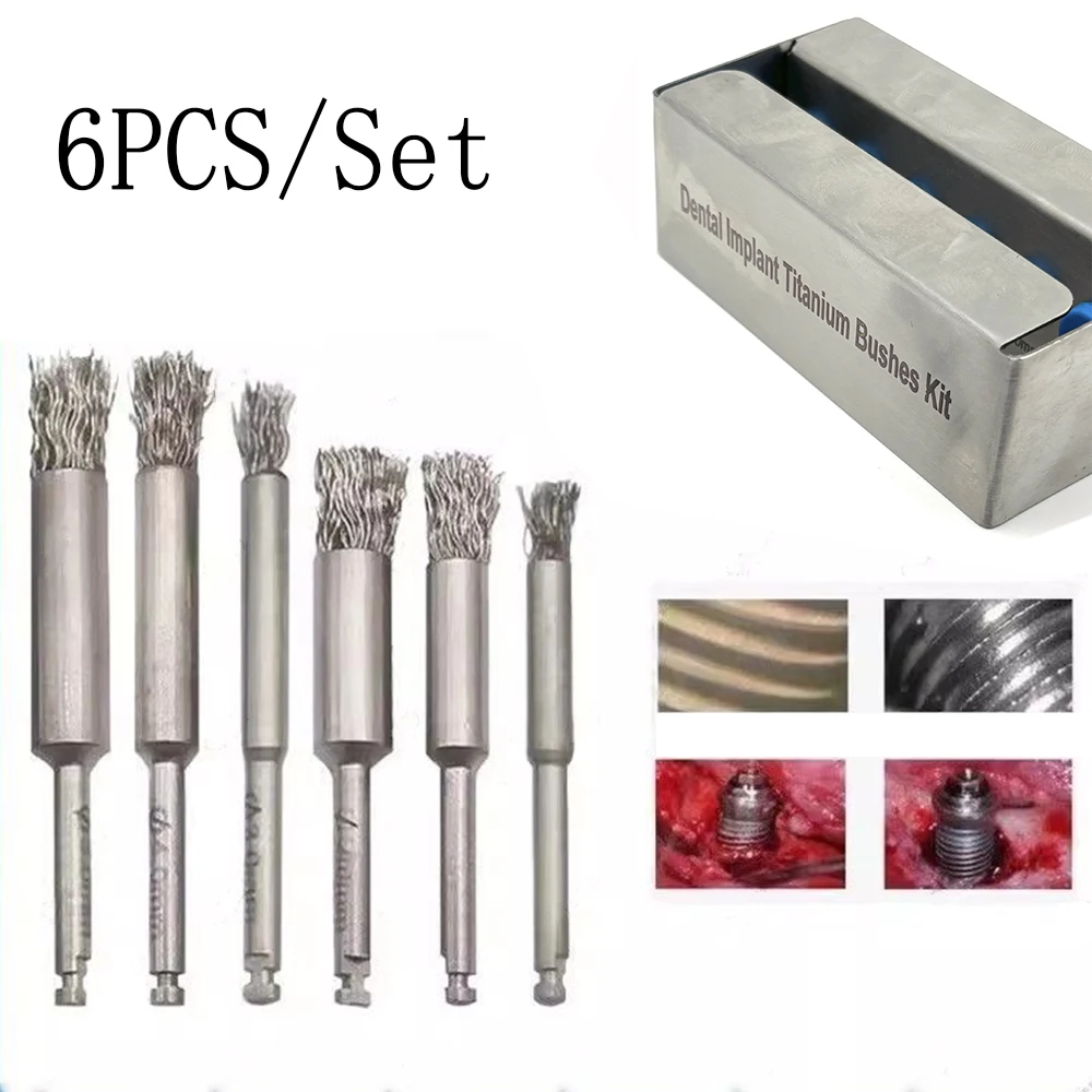 

Dental Implant Surface Cleaning Brush Peri-Implantitis Threads Tool Abutment Cleaning Implant Brush Fixture Cleaning Brush