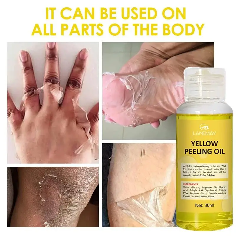 Óleo de peeling amarelo para pele escura, esfoliante, clareamento, manchas, joelho, dedo, remover a pele morta, melanina, clareamento, iluminar o corpo, cuidados com a pele