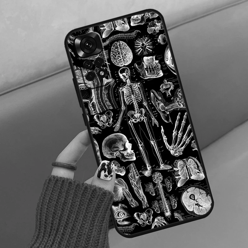 Skeleton  Bones Case For Xiaomi Redmi Note 10 Pro 8 9 12 11 Pro 8T 9S 10S 11S Redmi 9 10 10C 9A 9C Cover