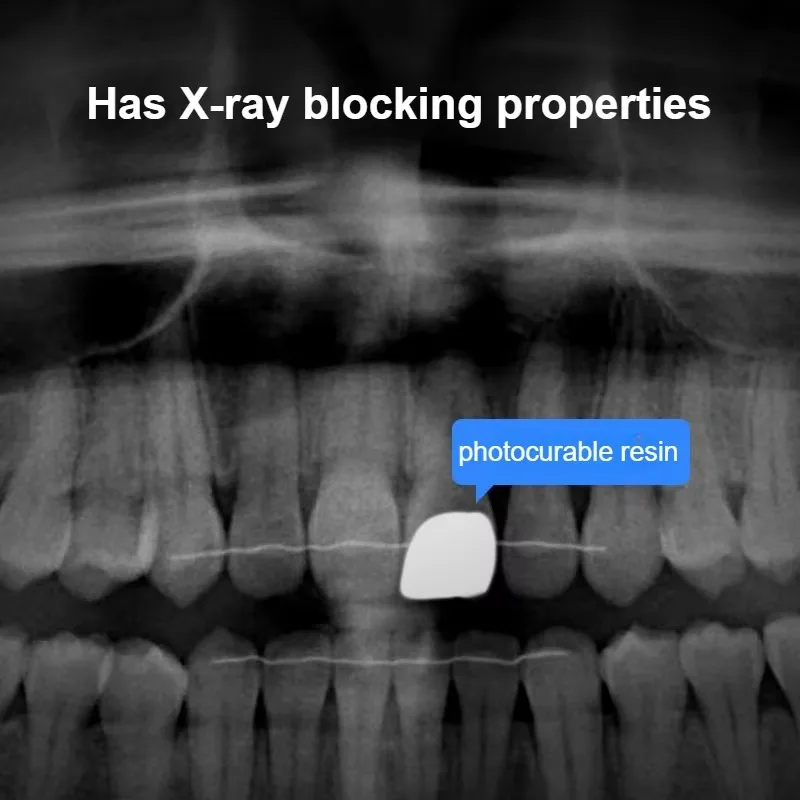 A1 A2 A3 Dental Composite Resin Nanometer Solid Resin Light Curing Delivery Tips Etch Gel Bonding Flowing Dentist Consumables