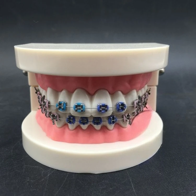 Stomatological Teaching Aids 1:1 Standard Dentition Model, Colored Ligation Ring, Orthodontics Bow Ribbon Bracket s