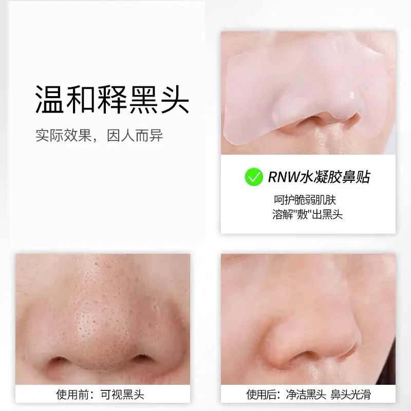 RNW Nose Mask Blackhead Remover Nose Patch Shrink Pores Plant Purification Deep Cleansing Acne Oil-control Nose Mask SkinCare