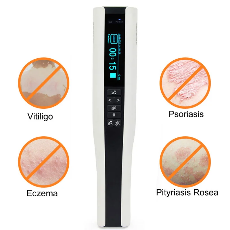 psoriasis uvb lamp kn4003 rechargeable 311nm uvb device for vitiligo household medical device vitiligo uvb phototherapy