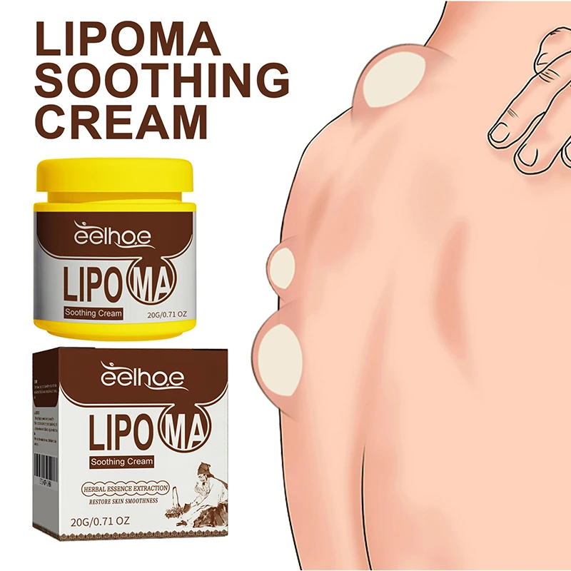 Soothing Cream Subcutaneous Lumps Remover Treatment Medicine Liquid Apply To Skin Swelling Cellulite Fibroma Fat Mass Plaster