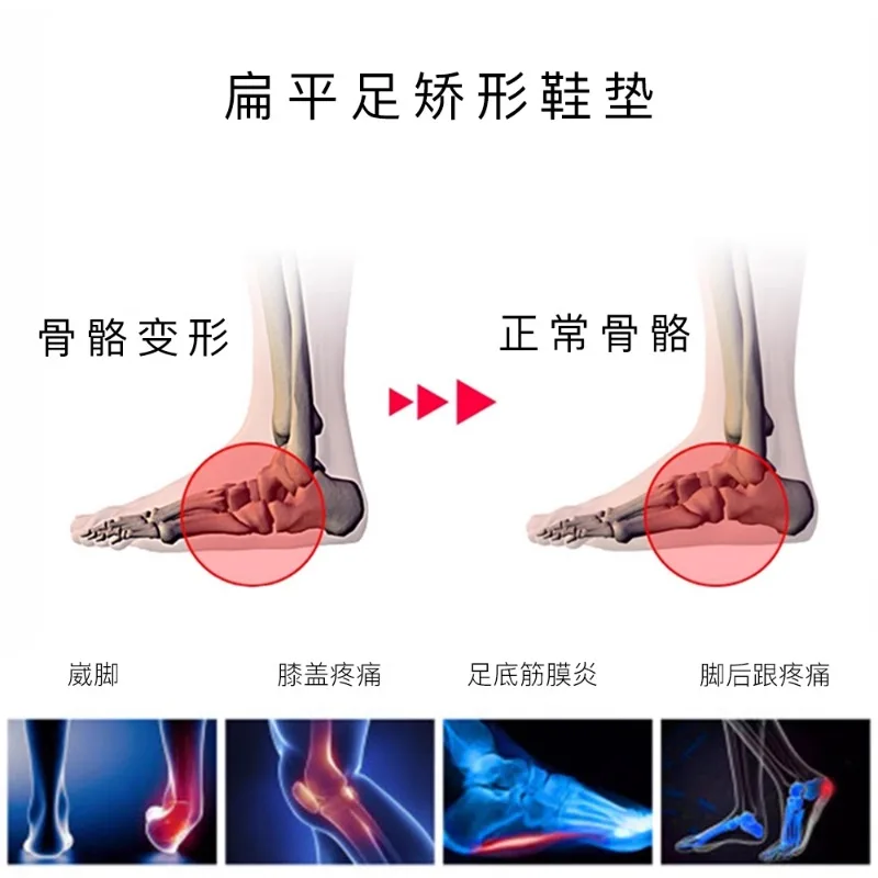 Bicycle insole arch support insole flat foot corrector insole orthotic pad