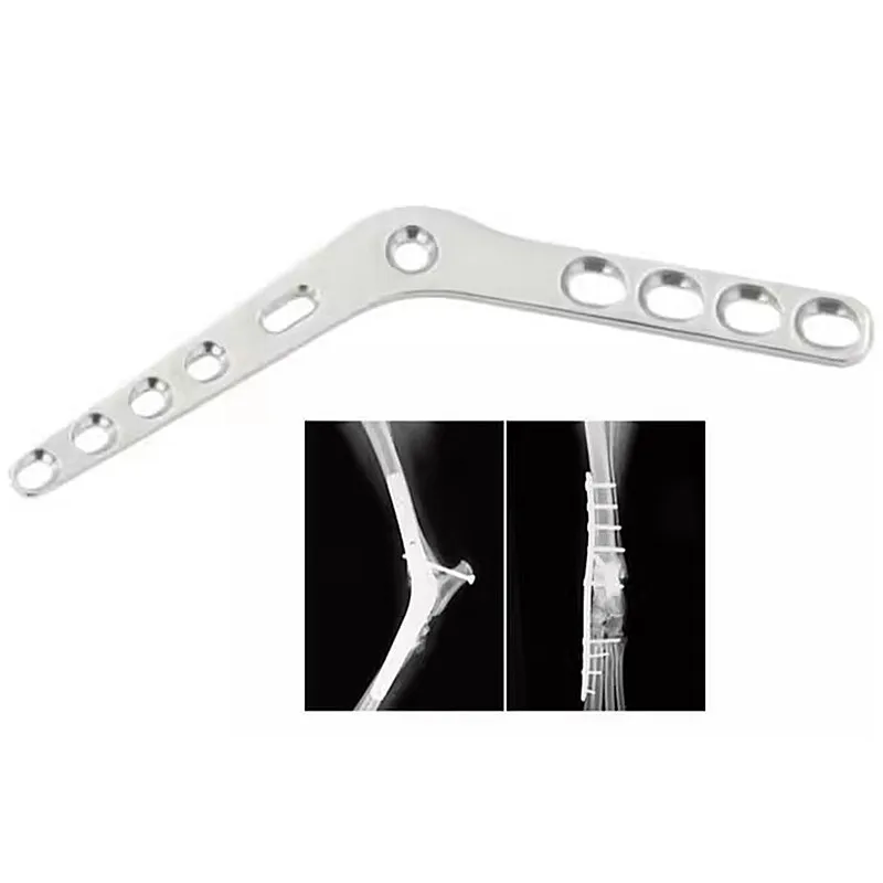 Pantarsal arthodesis locking plates AO voi dog Veterinary Instrument equipments animal orthopedic tiny animals tplo vet tool pet