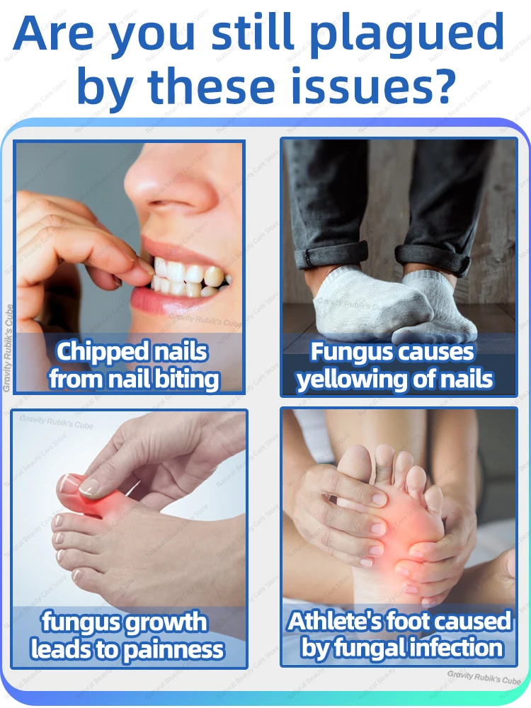 Fungal Nail Laser Device Repair Fast  Nails Fungus