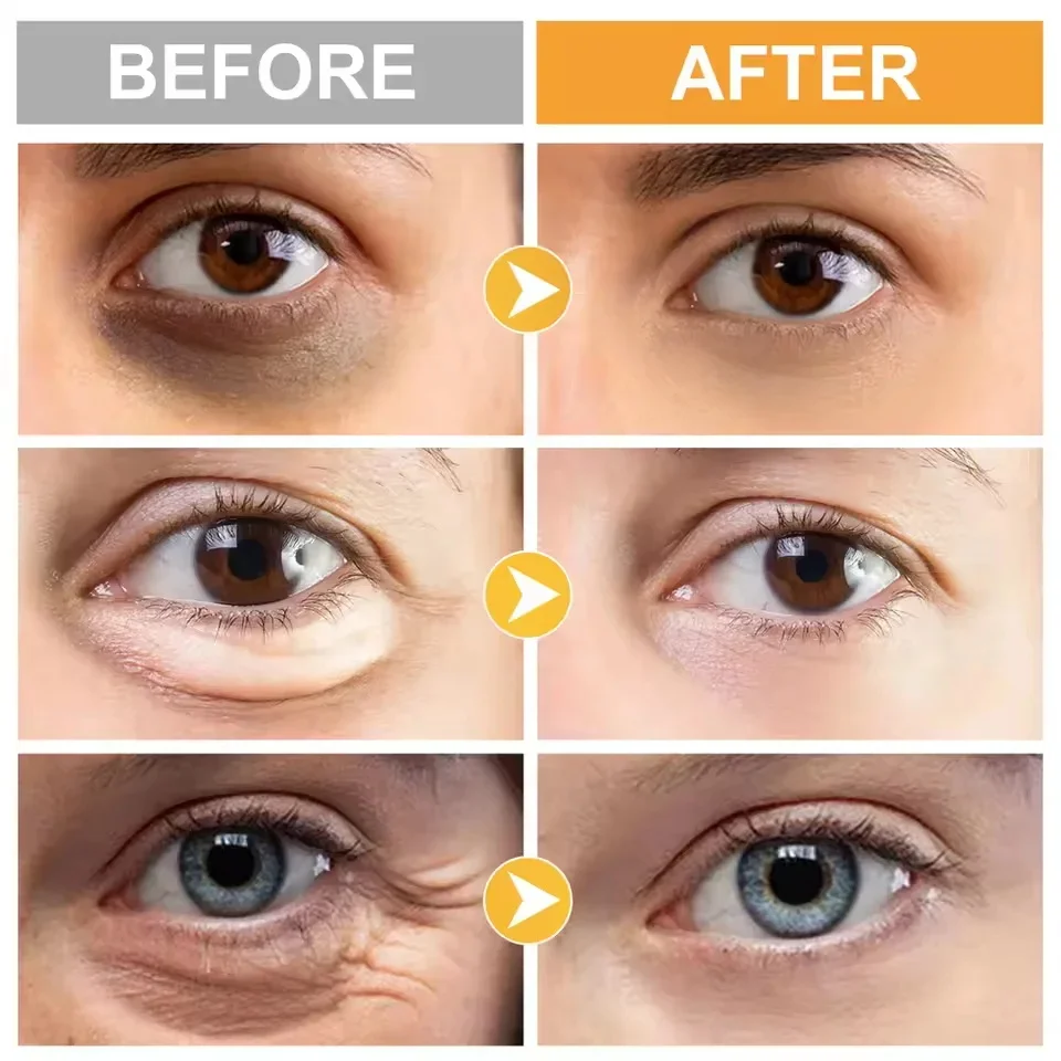 Creme instantâneo para remoção de bolsa de olhos, retinol, anti-rugas, firmador da pele, linhas finas, anti-círculo escuro, inchaço, iluminar, cuidados com os olhos