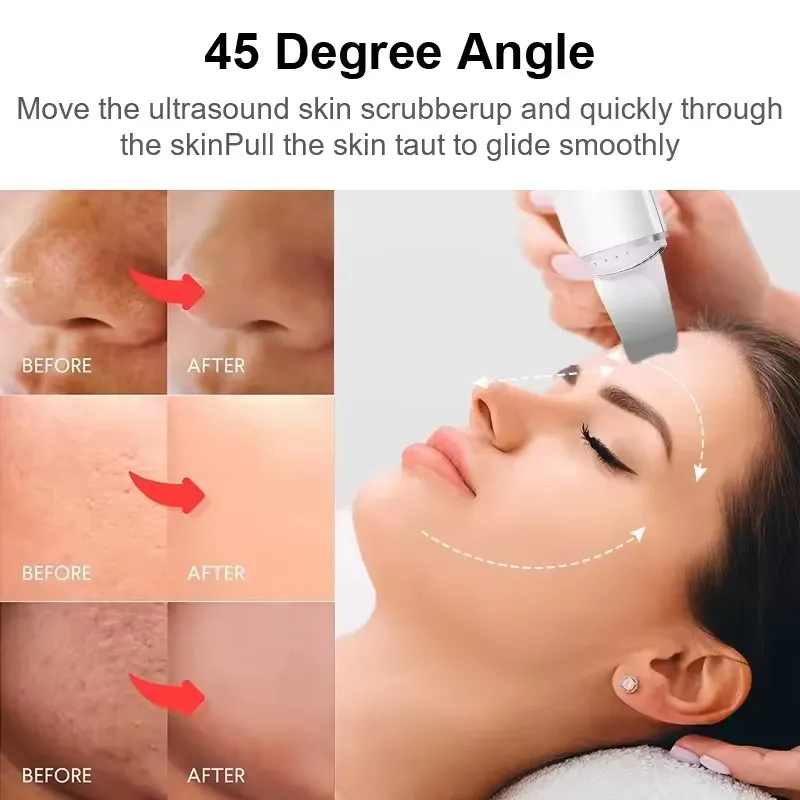Zai xiao purificador ultrassônico da pele, espátula facial vibratória, removedor de cravo, pá limpa, cavitação, peeling, levantamento facial
