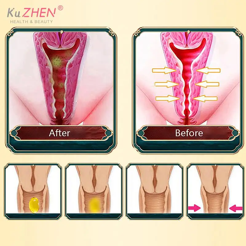 Female Firming Pill Vaginal Tightening Vagina Shrinking Feminine Hygiene Repair Stick Firming Vagina Female Private NursingCare