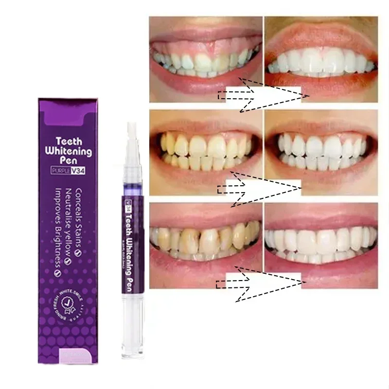 Teeth Whitening Pen Teeth Brightening Essence V34 Dental Care Serum Remove Plaque Tooth Stain Eliminate Smoke Stain Tea Stain