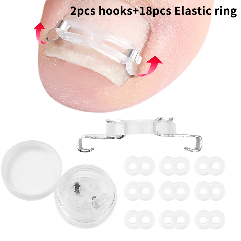 1 Set Ingrown Toenail Corrector Kit - Professional Tools for Embedded Toenail Recovery & Foot Care