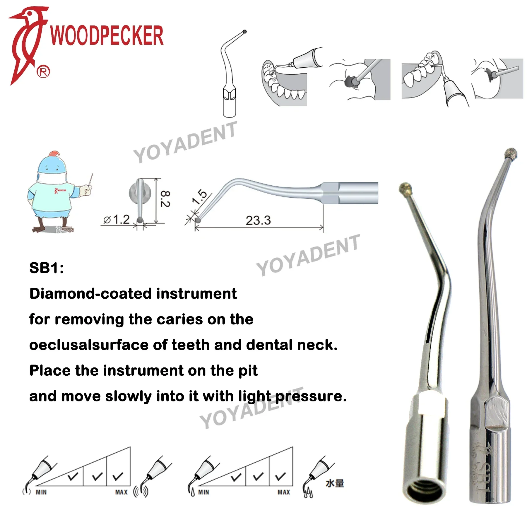 Woodpecker Dental Ultrasound Scaler Tips Cavity Preparation Scaling Tips SB1 Fit EMS UDS Ultrasonic Scaler Handpiece