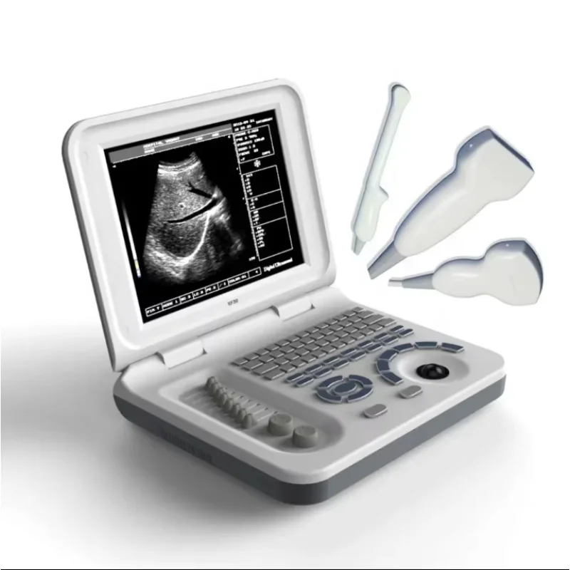 Doctor Toy Ultrasound Machine Second Hand Ultrasound Sono Ultrasound