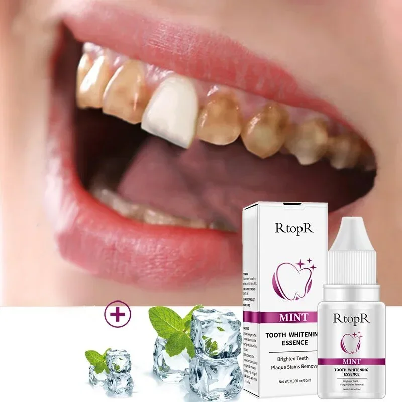 Rtopr-Essência De Clareamento De Dentes, Produtos De Remoção De Placa Dentária, Creme dental de saúde bucal, Cuidado dentário