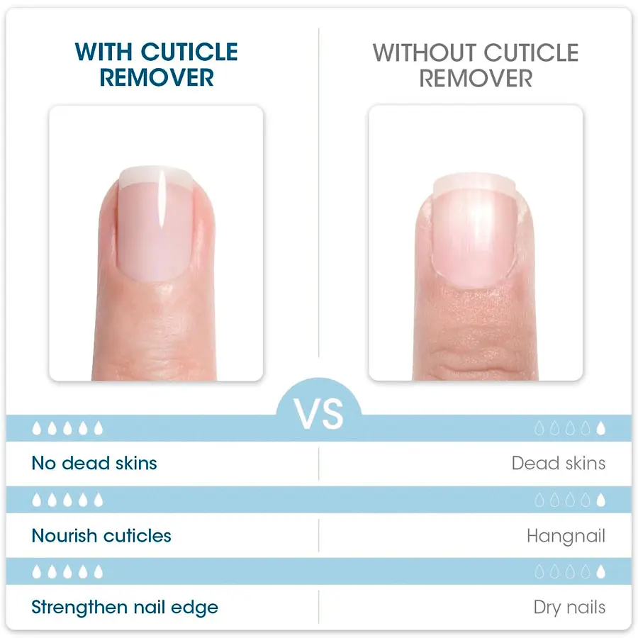 QAZIXU 10ml Nail Care Cuticle Remover Nail Polish for Dead Skin Gel Manicure Treatment Tool or Pedicure Nails Care