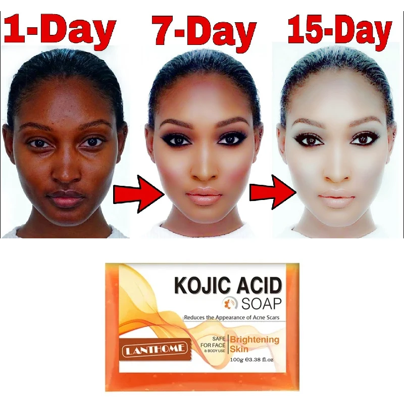 Kojic Acid Soap Original Cleanses Skin with Hand-made Whitening Soap for Deep Cleansing and Brightening Skin Tone Antimicrobial