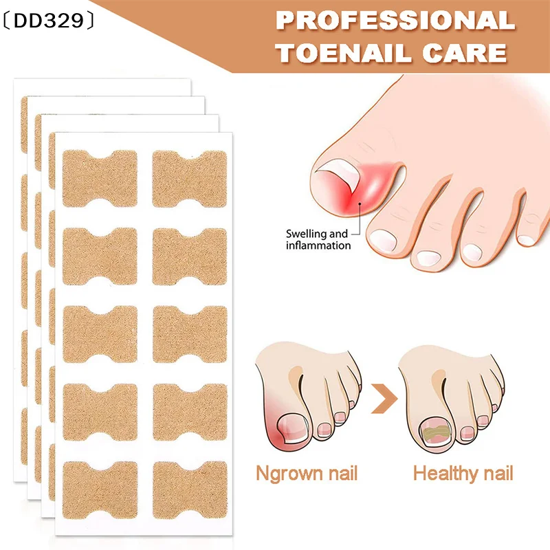 maveraDD329 Lapiza60Pcs Autocollants de Correction des Ongles Incarnés Patchs Correcteur d'ongle Patchs Traitement Récupérer Correcteur Pédicure Outil de Soin des Ongles