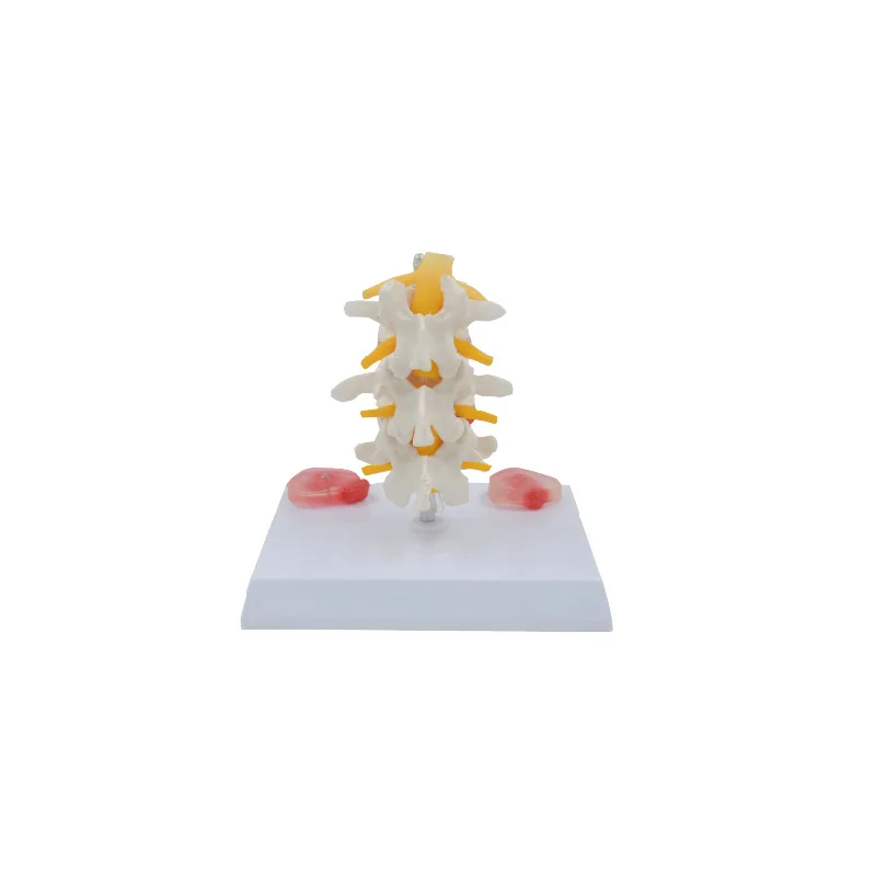 Three-level Lumbar Intervertebral Disc Disease Anatomy Model Medical Teaching Tools Drop Shipping