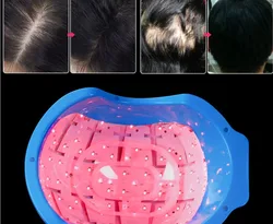 Promuove o recrescimento do cabelo capacete a laser 180pcs luzes LED tampa de crescimento do cabelo infravermelho anti perda de cabelo terapia máquina de massagem