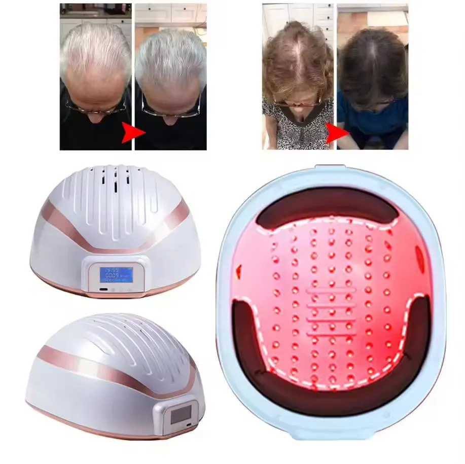 Rechargeable Laser Hair Growth Helmet Red Light Therapy Cap Lllt Led Hair Growth Helmet for Effective Head Treatment for Hair