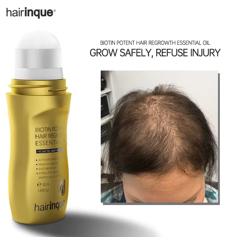 Purc Haarwuchs öl Haarwuchs produkte für Männer Frauen Biotin Vitamin Anti Haarausfall schnelles Nachwachsen verdicken Öl Haarpflege