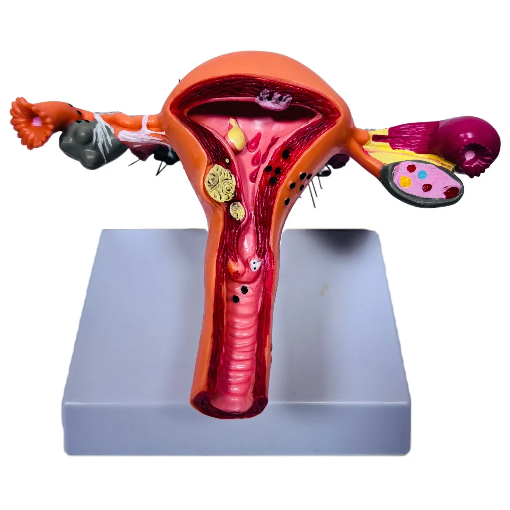 

Медицинская наука Модель патологической матки человека для преподавания