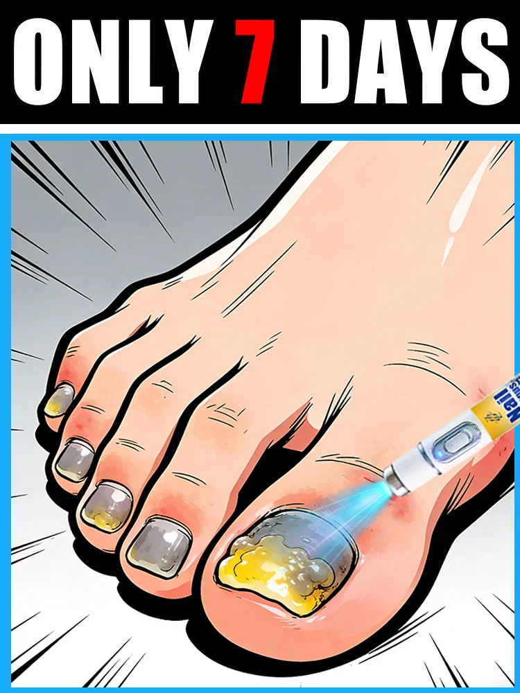 

New 2026 Offer! Free Shipping! Tea Tree Nail Solution