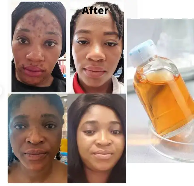 

Glutathione Best Skin Brightening, Anti Aging Serum Dark Spot Remover, Aged Spots, Perfect Glowing Skin