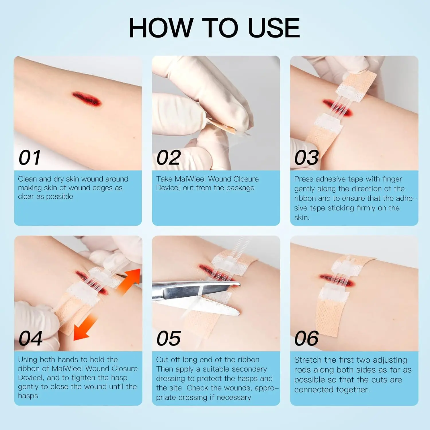 Zip Stitch Emergency Wound Closures Device Repair Wounds Without Stitches Zip Sutures Butterfly Bandaids Health Care