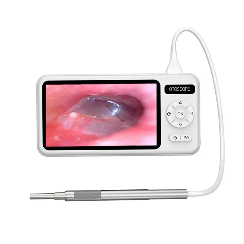 

Инновационный цифровой отоскоп, камера-вкладыш, инструмент для удаления ушной серы, визуальная ушная ложка поддерживает фотозащелки, средство для чистки ушей