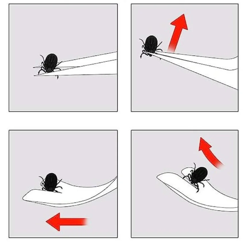 ثلاث قطع الحيوانات الأليفة مكافحة الآفات أداة مجموعة القط والكلب قمل وأشار كليب القراد إزالة شوكة مجرفة مكافحة الآفات مزدوجة الرأس كليب مجموعة