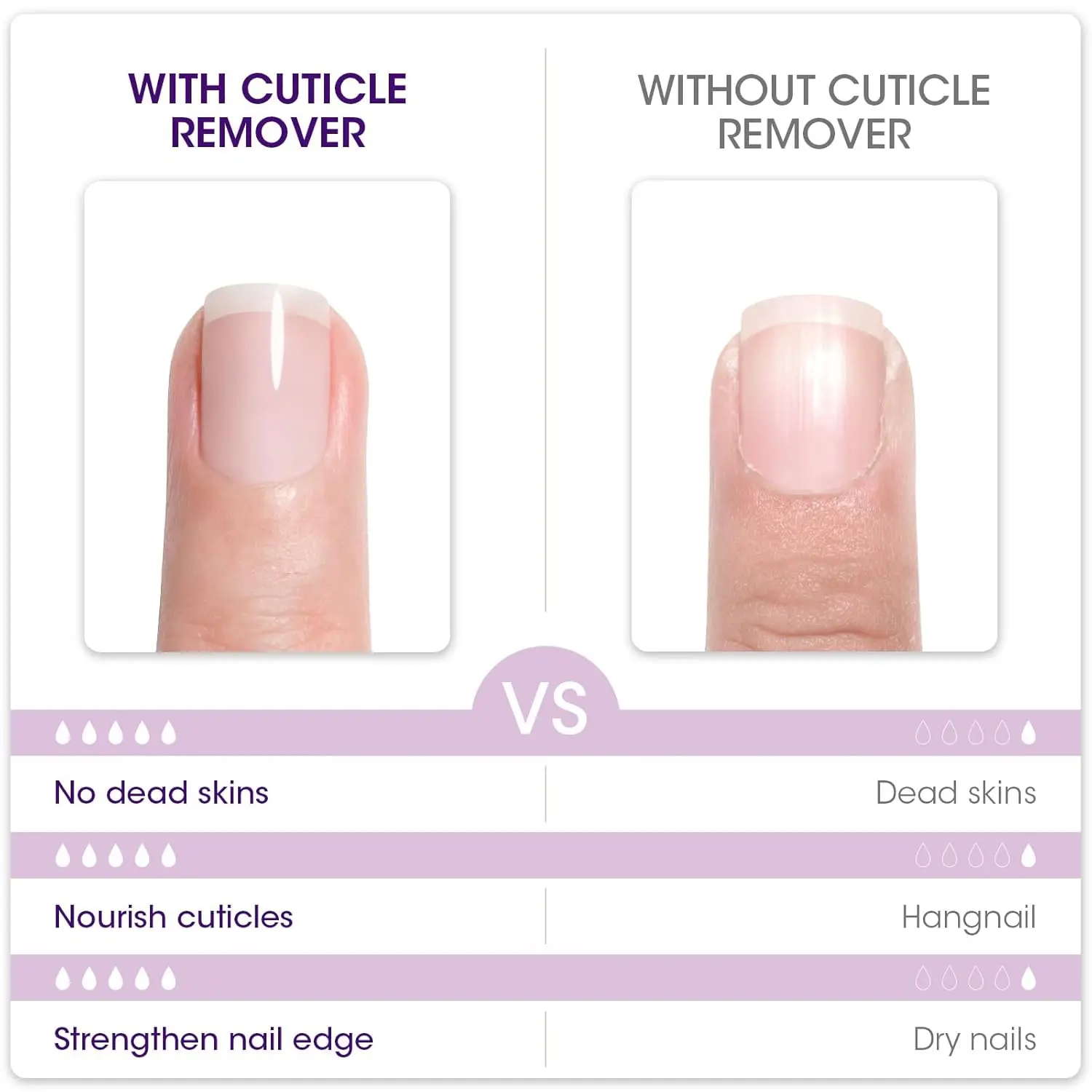 Cuticle Remover Instant Nail Softener Shea Butter Moisturizing Professional Cream Dry Dead Skin Overgrown Nail Care Treatment view 3