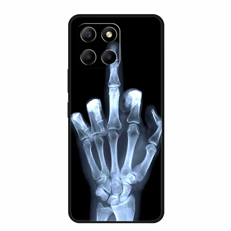 For Honor X7c Case X 7 c Phone Cover Lion Wolf Black Silicone Soft Back Cover Case For Honor X7c Case HonorX7c X7 c X 7c 6.77\