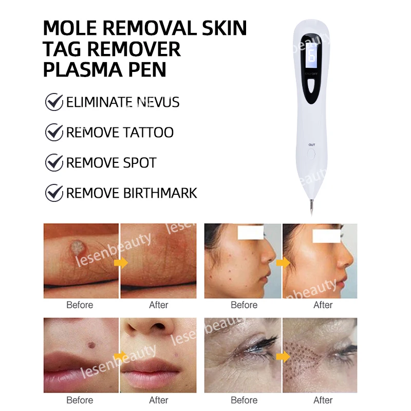 Mini pluma de Plasma láser, máquina portátil de eliminación de pecas, herramienta removedora de marcas de verrugas y cara, eliminador de tatuajes de puntos negros para el hogar