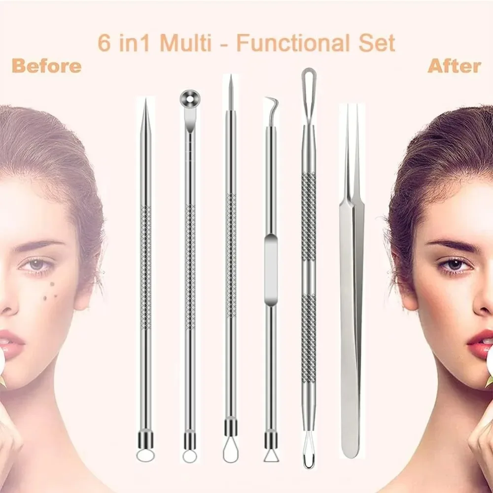 ​6Pcs Stainless Steel Blackhead Remover Tools Comedone Extractor Tweezers Kit for Acne Blemish Facial Skin Care Precision Set​