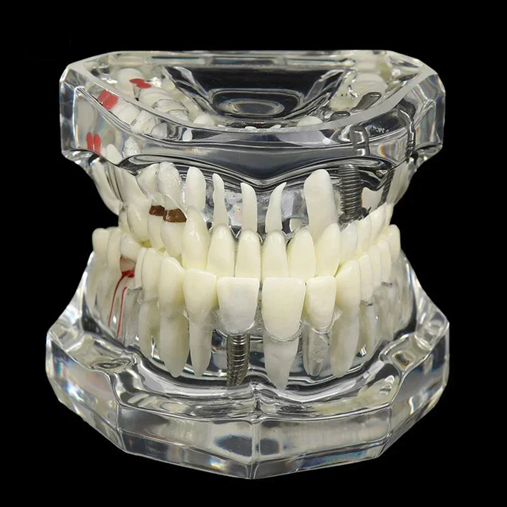 Thumbnail 2 - #47 Dental Teaching Models List of Top Picks