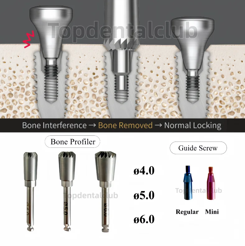 Dental Implant Bone Profiler Kit Torque Driver Bone Removal Guide for OSS Surgical Tool Ø4.0/5.0/6.0mm