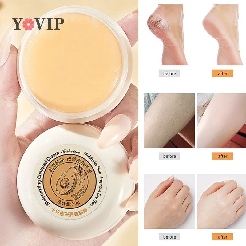 

Herbal Anti Cracked Heel Treatment Cream Anti-Drying Removal Callus Dead Skin Balm Hand Foot Moisturizing Repair Skin Care Mask